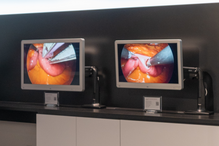 Surgical Monitors